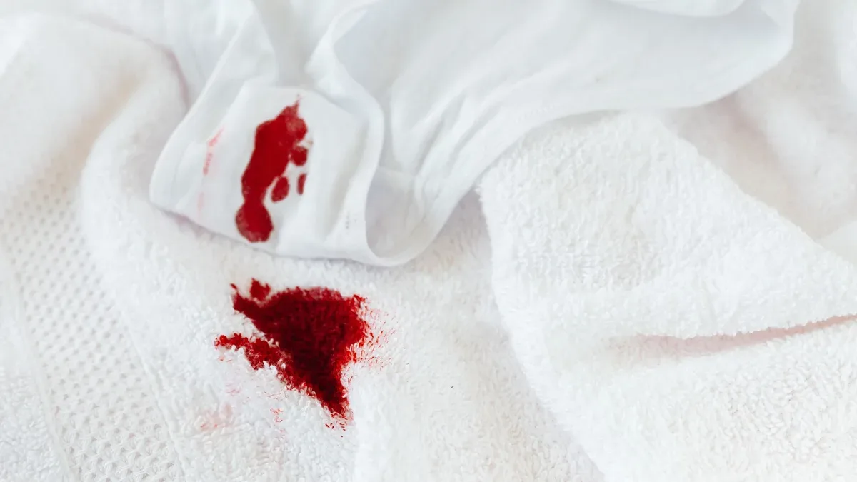 linge deteint astuce grand mere — Linge déteint astuce grand-mère : K2R linge déteint